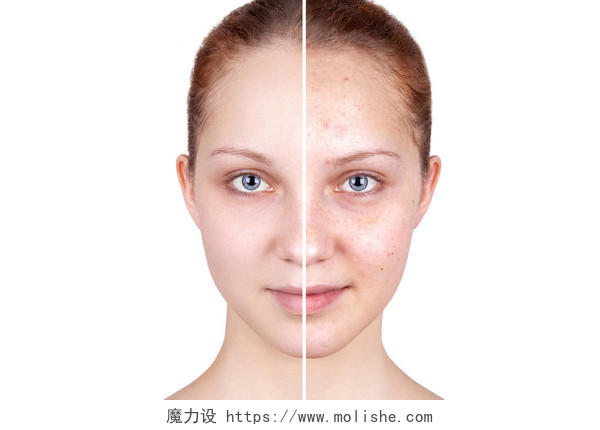 缺乏护理的皮肤与护理后的皮肤的对比